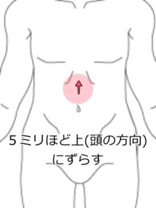 胃の持ち上げ3